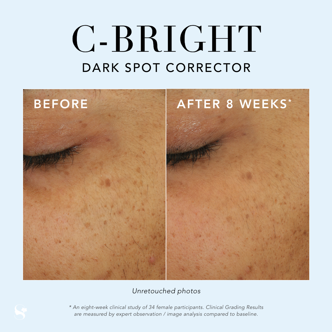 C-Bright Dark Spot Corrector