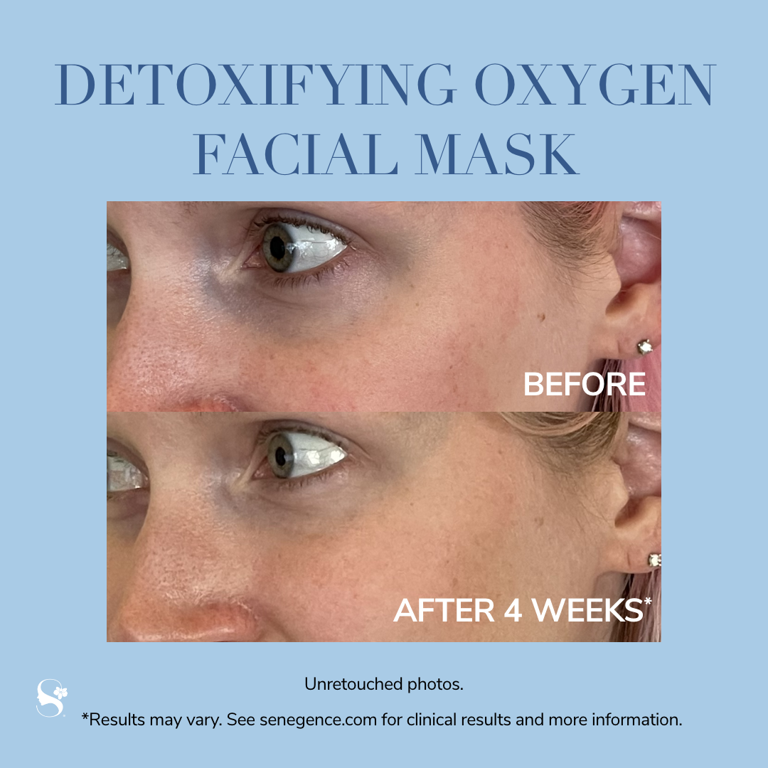 Detoxifying Oxygen Facial Mask
