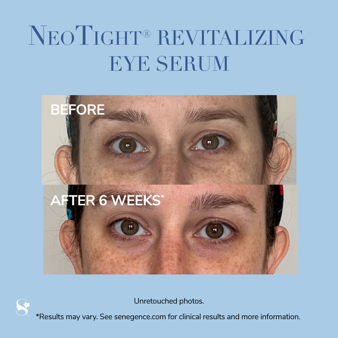NeoTight Revitalizing Eye Serum
