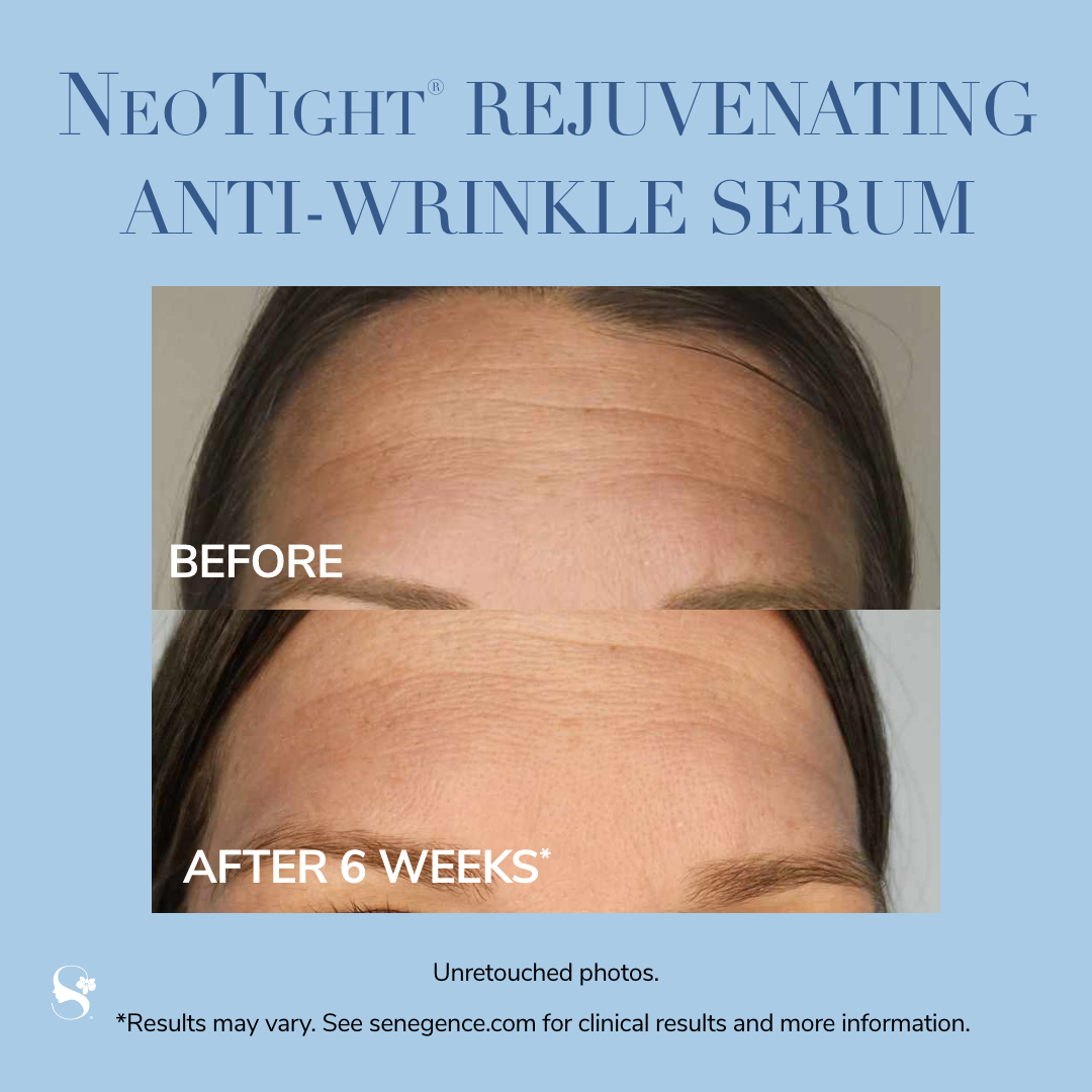 NeoTight Rejuvenating Anti-Wrinkle Serum