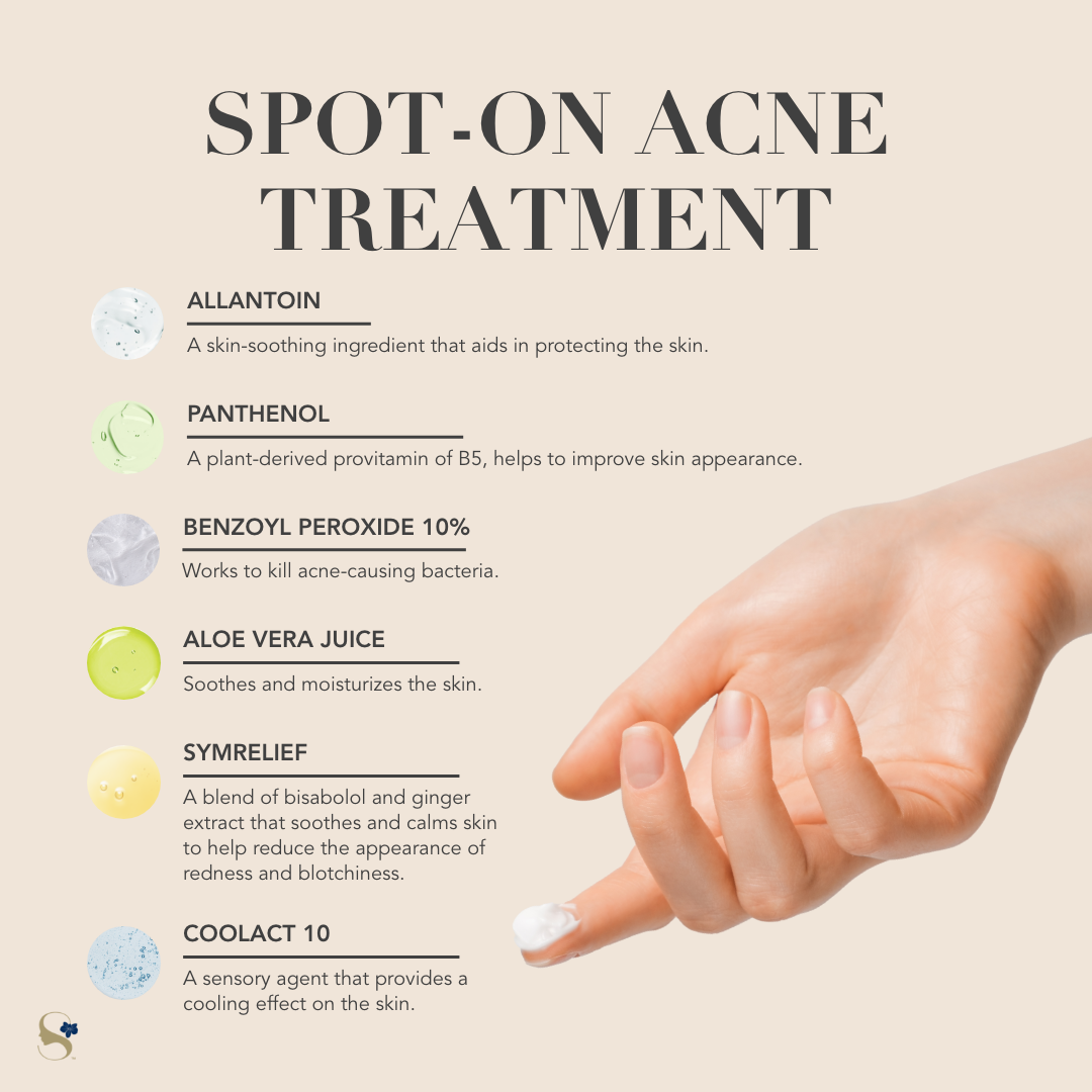 Spot-On Acne Treatment