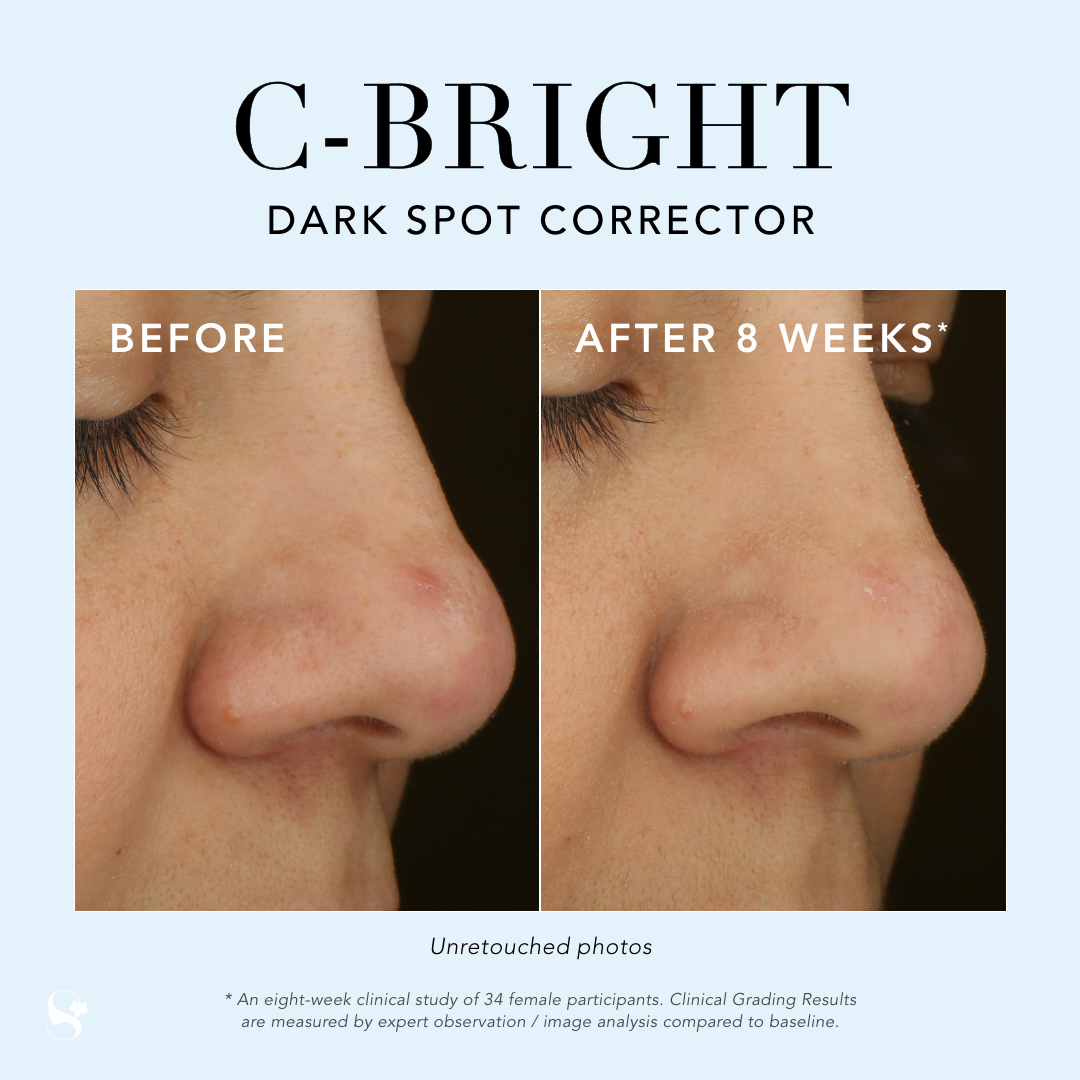 C-Bright Dark Spot Corrector