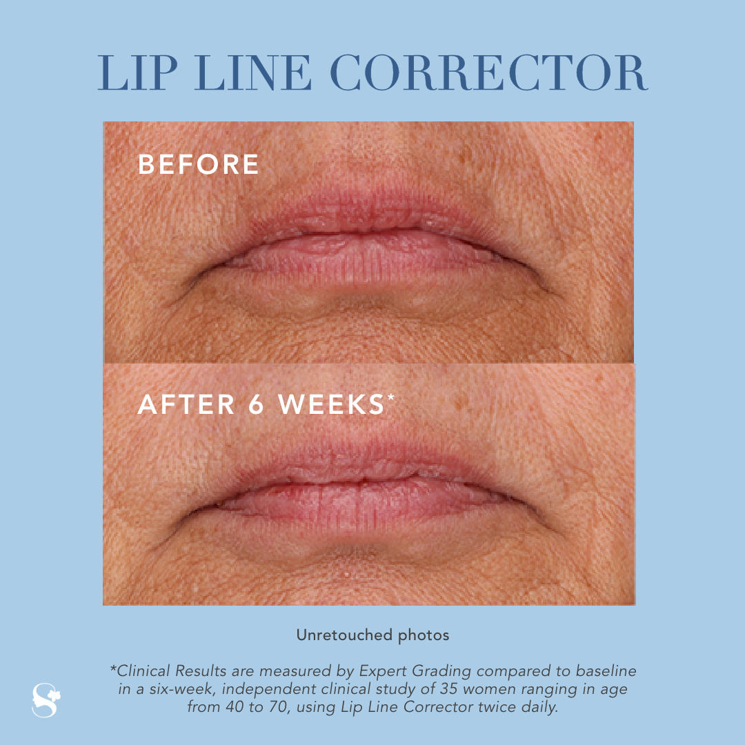 Lip Line Distorted Lip Line Corrector – Nealy's LipRx
