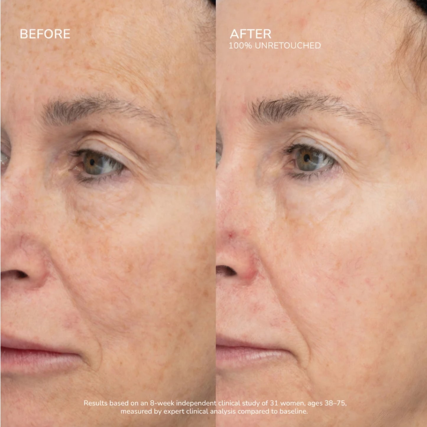 SeneCell SenePlex+ StemCell Concentrate
