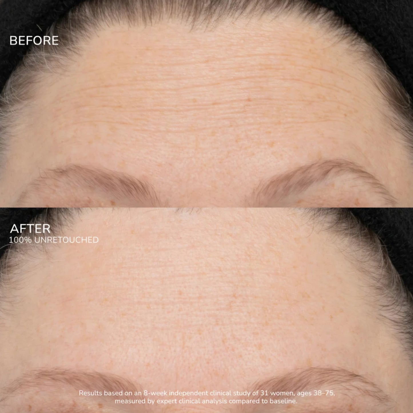SeneCell SenePlex+ StemCell Concentrate