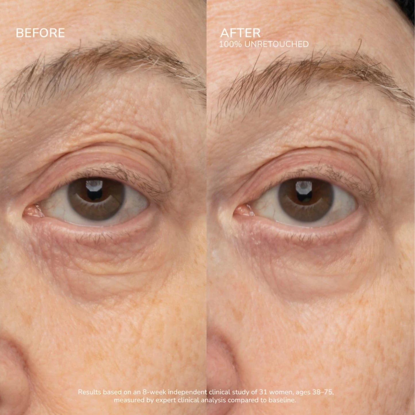 SeneCell SenePlex+ StemCell Concentrate